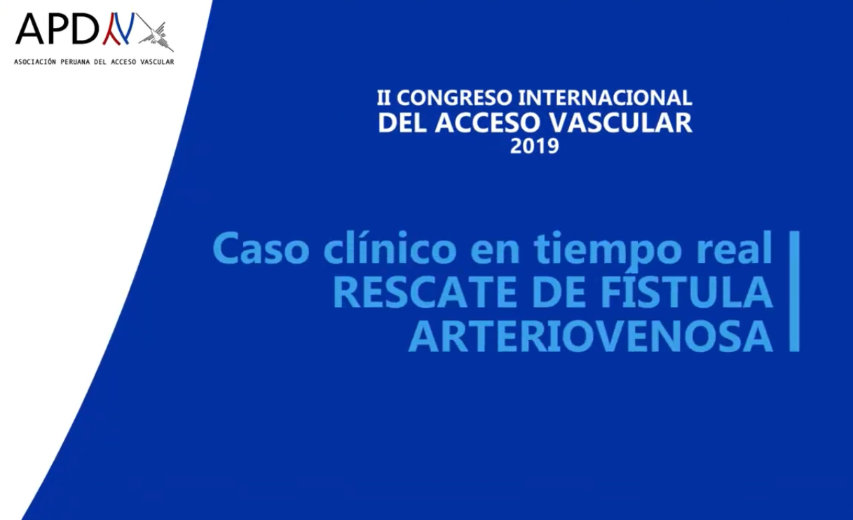 Read more about the article Presentación de caso clínico en tiempo real de rescate de FAV por radiología intervencionista